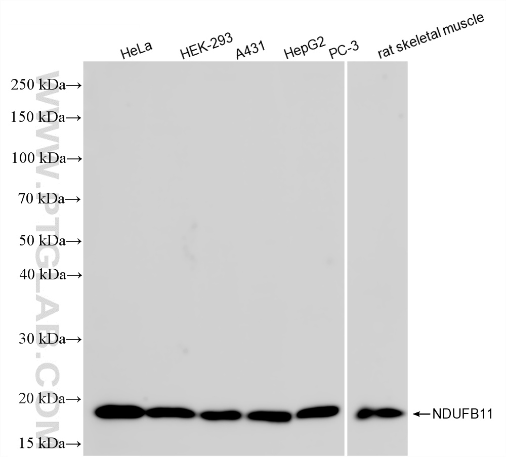 WB analysis using 87048-2-RR (same clone as 87048-2-PBS)