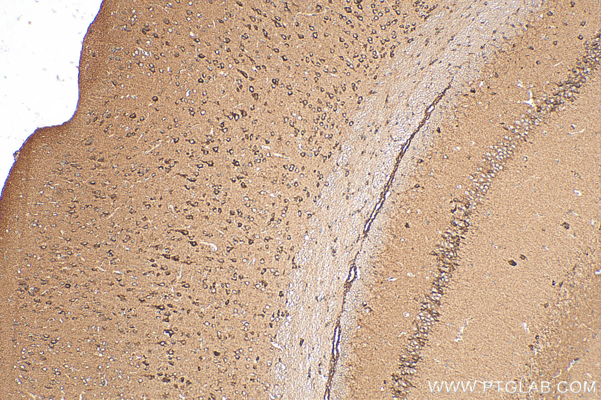 IHC staining of mouse brain using 17614-1-AP
