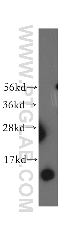 WB analysis of human heart using 12358-1-AP