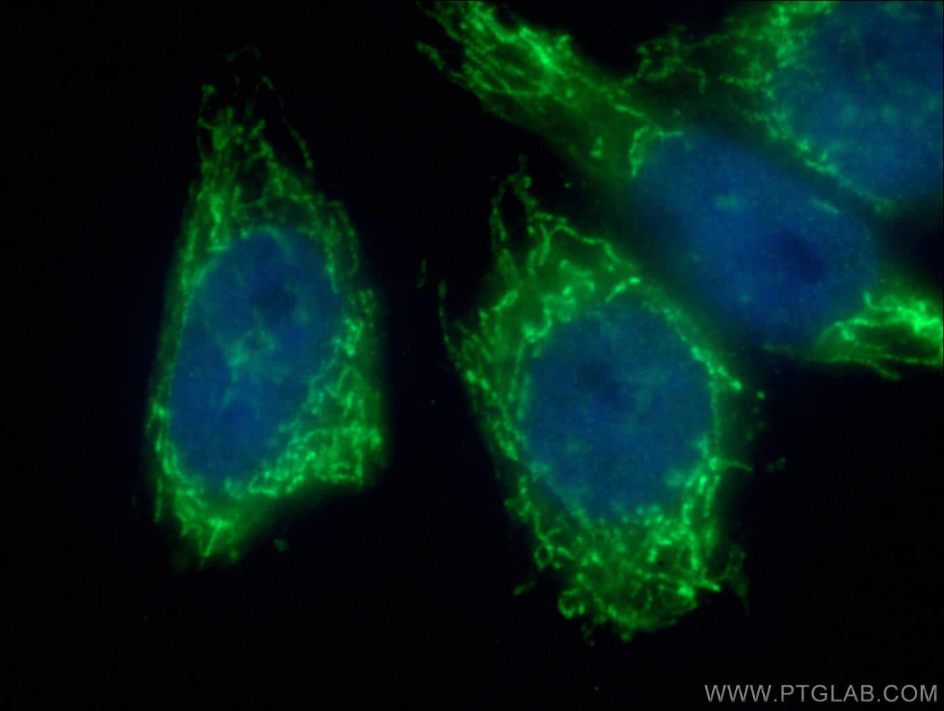 IF Staining of HeLa using 27931-1-AP