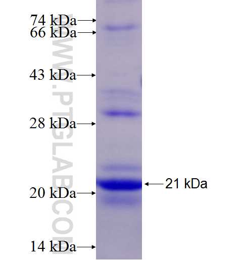 NDUFB4 fusion protein Ag27484 SDS-PAGE