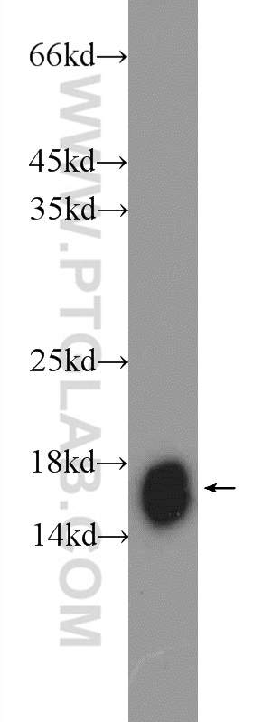 WB analysis of mouse liver using 23855-1-AP