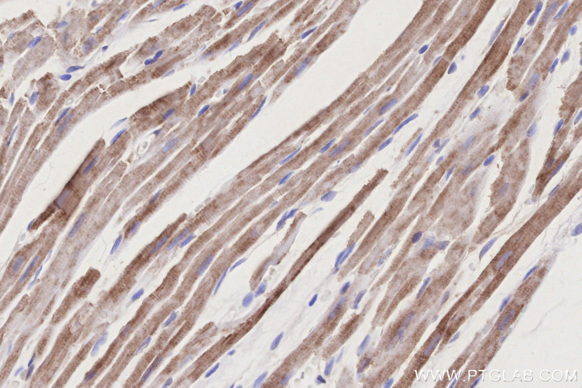 IHC staining of rat heart using 14912-1-AP IHC staining of rat heart using 14912-1-AP