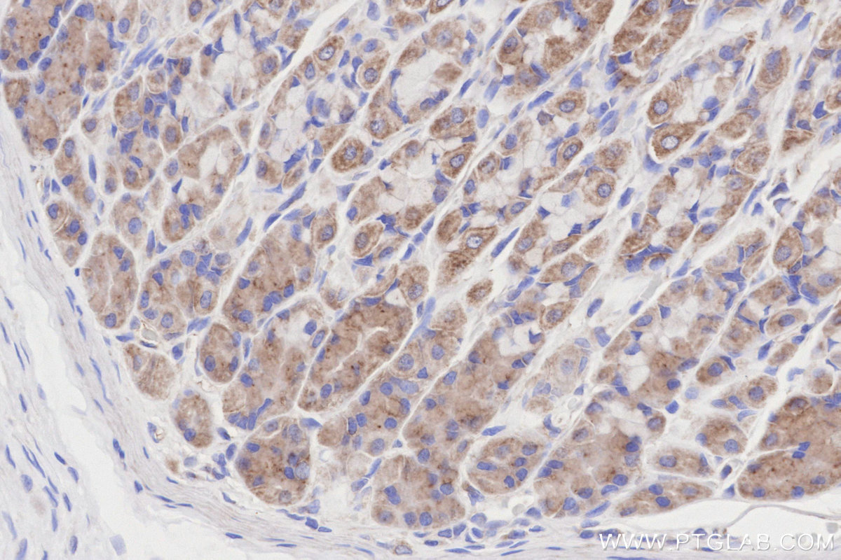 IHC staining of rat stomach using 14912-1-AP IHC staining of rat stomach using 14912-1-AP