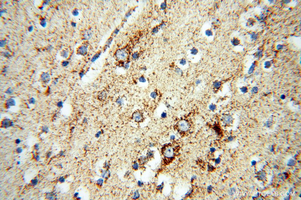 IHC staining of human brain using 14912-1-AP