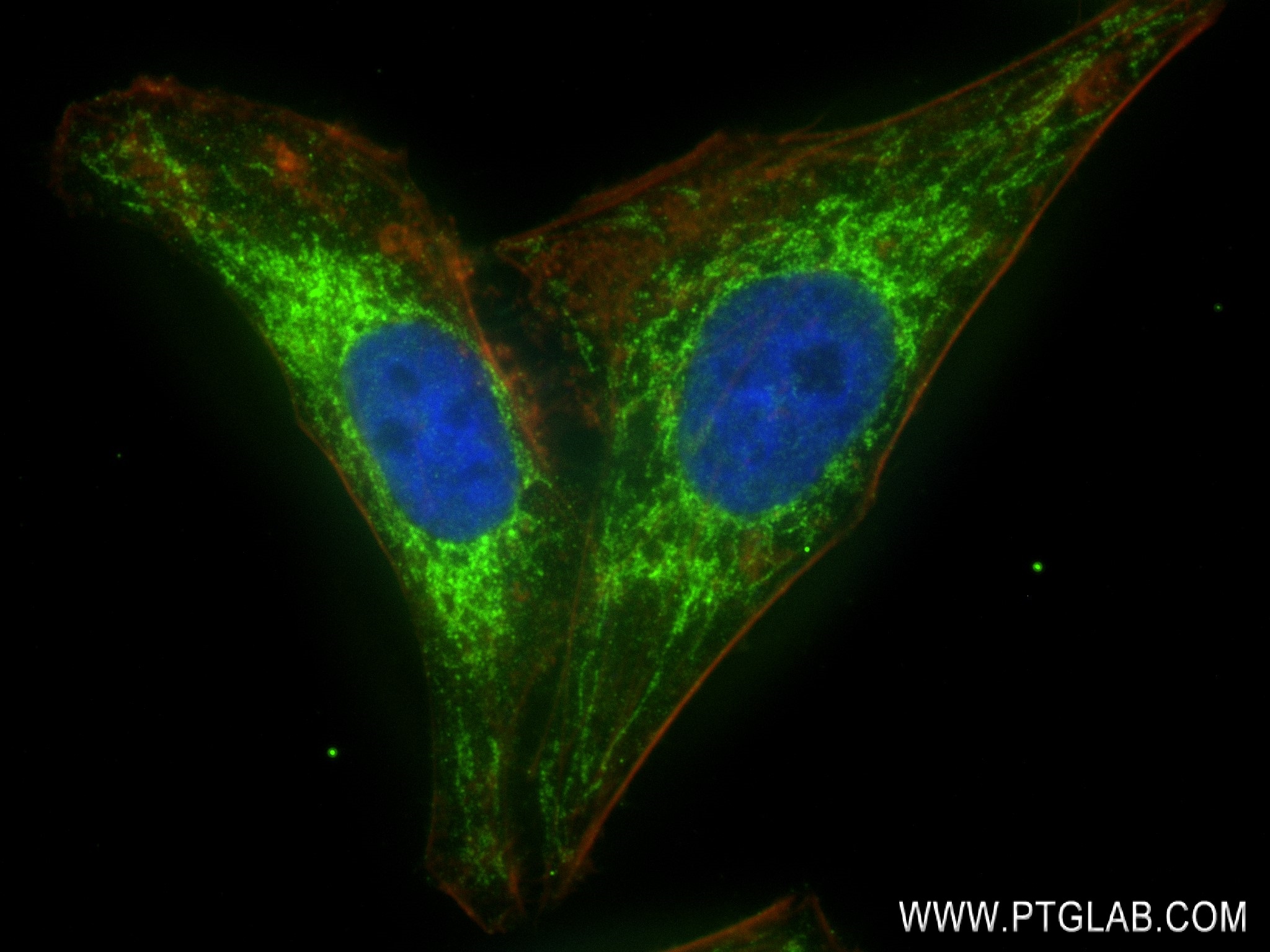 IF Staining of HepG2 using 83216-3-RR (same clone as 83216-3-PBS)