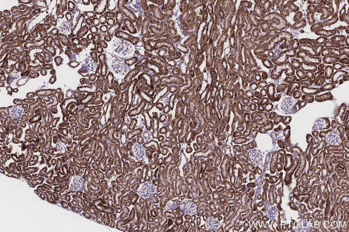 IHC staining of mouse kidney using 83216-3-RR IHC staining of mouse kidney using 83216-3-RR