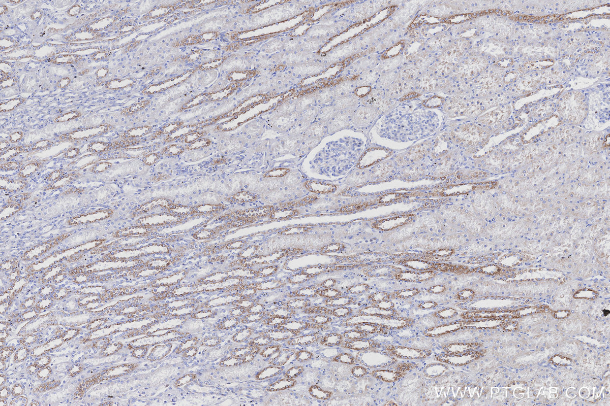 IHC staining of human kidney using 83216-3-RR IHC staining of human kidney using 83216-3-RR