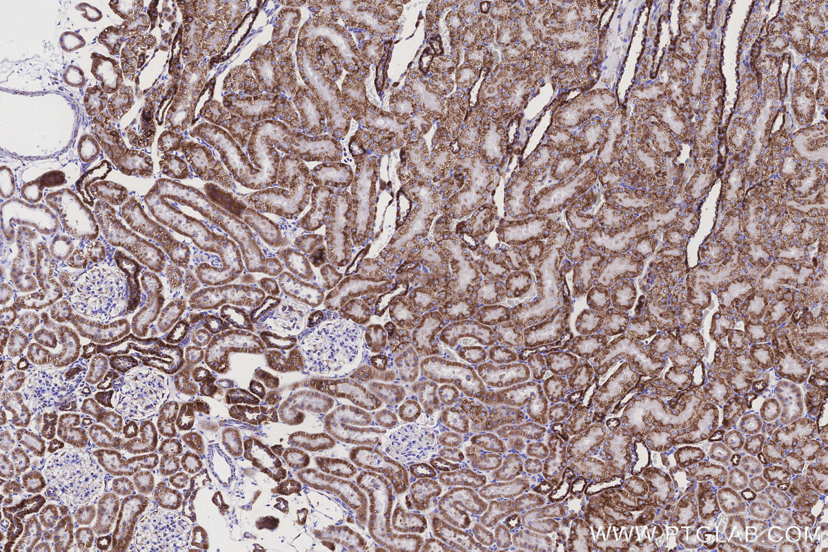IHC staining of rat kidney using 83216-3-RR IHC staining of rat kidney using 83216-3-RR