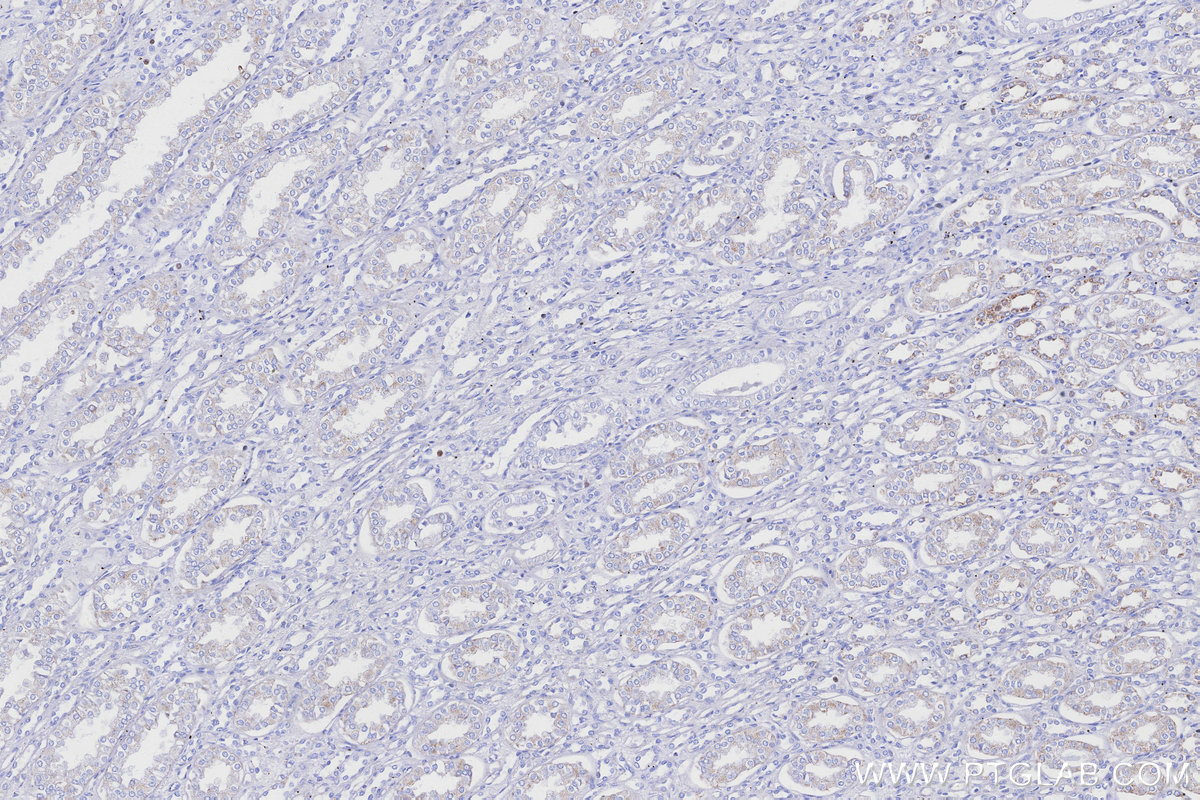 IHC staining of human kidney using 83216-3-RR IHC staining of human kidney using 83216-3-RR