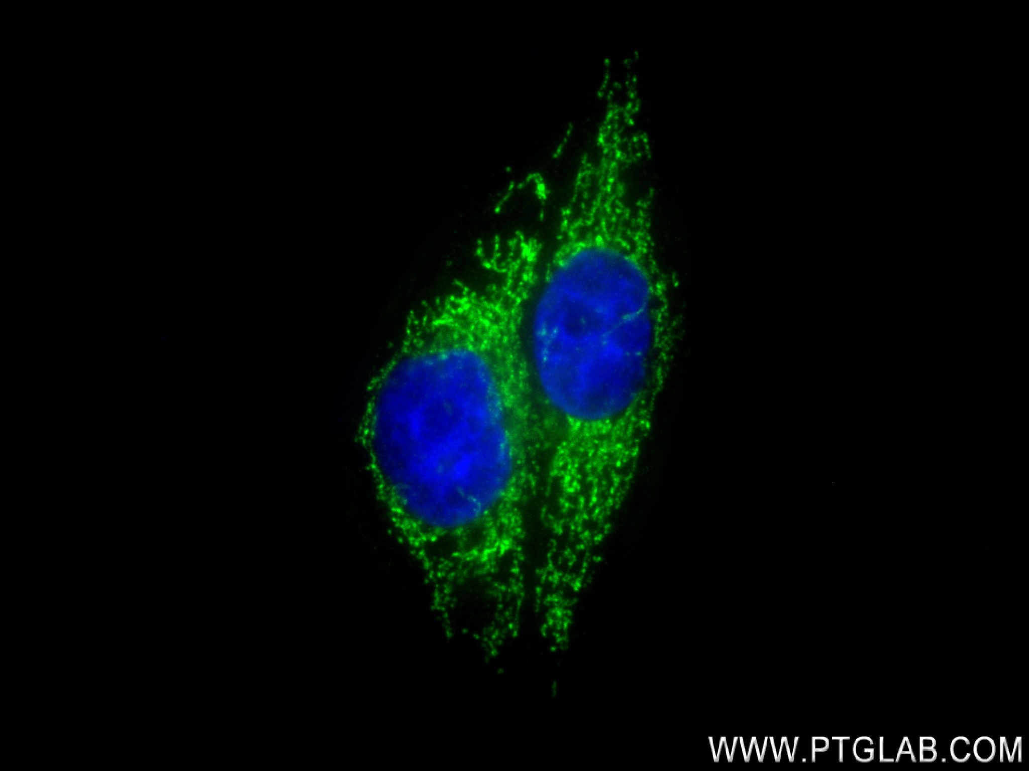 IF Staining of HepG2 using 83216-4-RR (same clone as 83216-4-PBS)