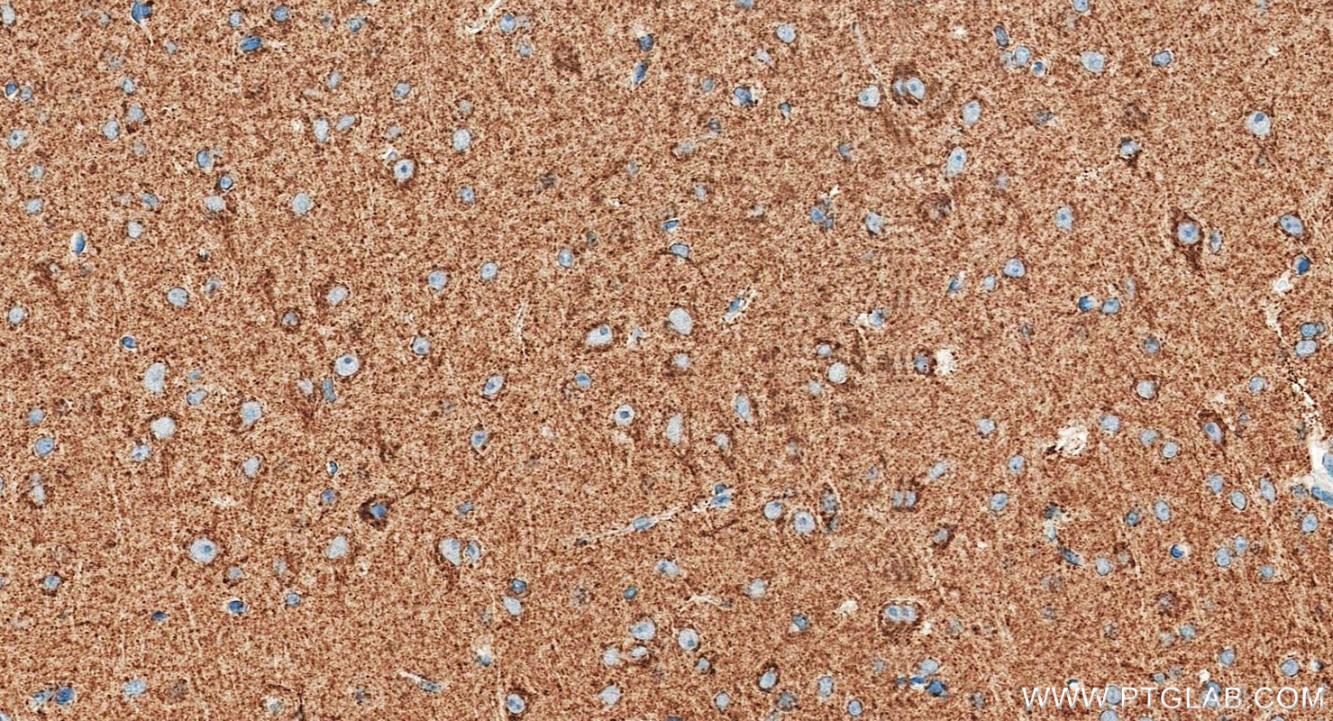 IHC staining of mouse brain using RMX00097