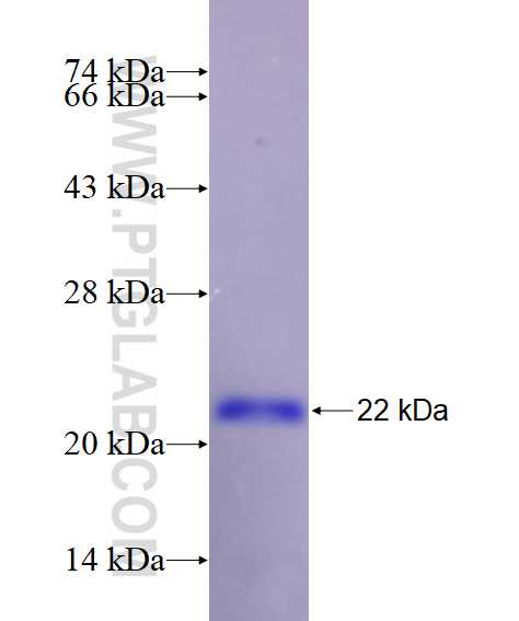 NDUFB9 fusion protein Ag7802 SDS-PAGE