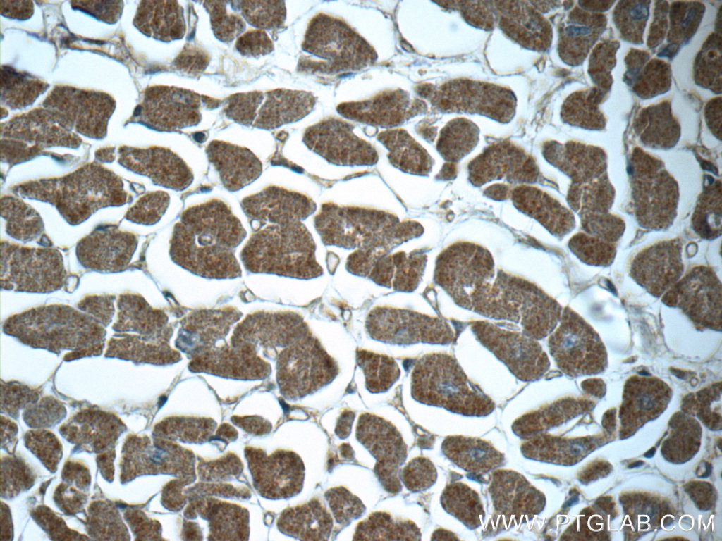 IHC staining of human heart using 23842-1-AP