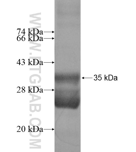 NDUFC1 fusion protein Ag12190 SDS-PAGE NDUFC1 fusion protein Ag12190 SDS-PAGE