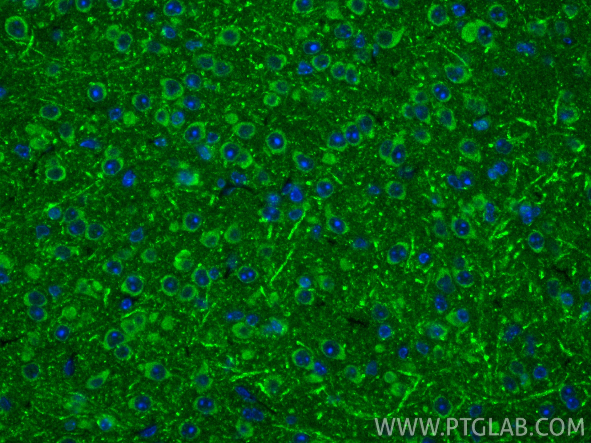 IF Staining of mouse brain using 15573-1-AP IF Staining of mouse brain using 15573-1-AP