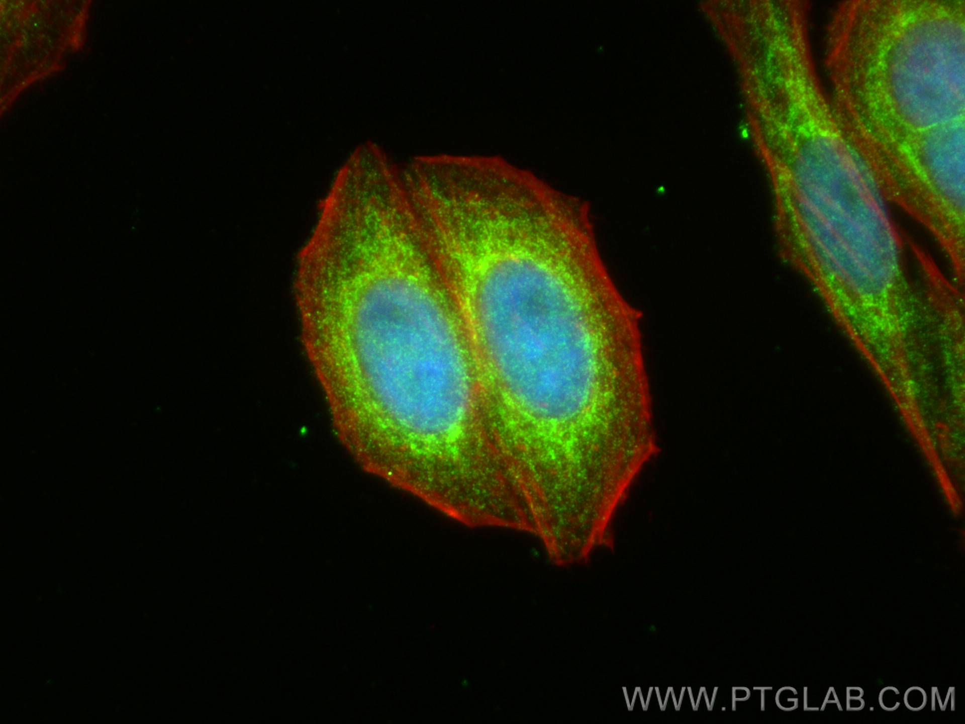 IF Staining of HepG2 using 12444-1-AP