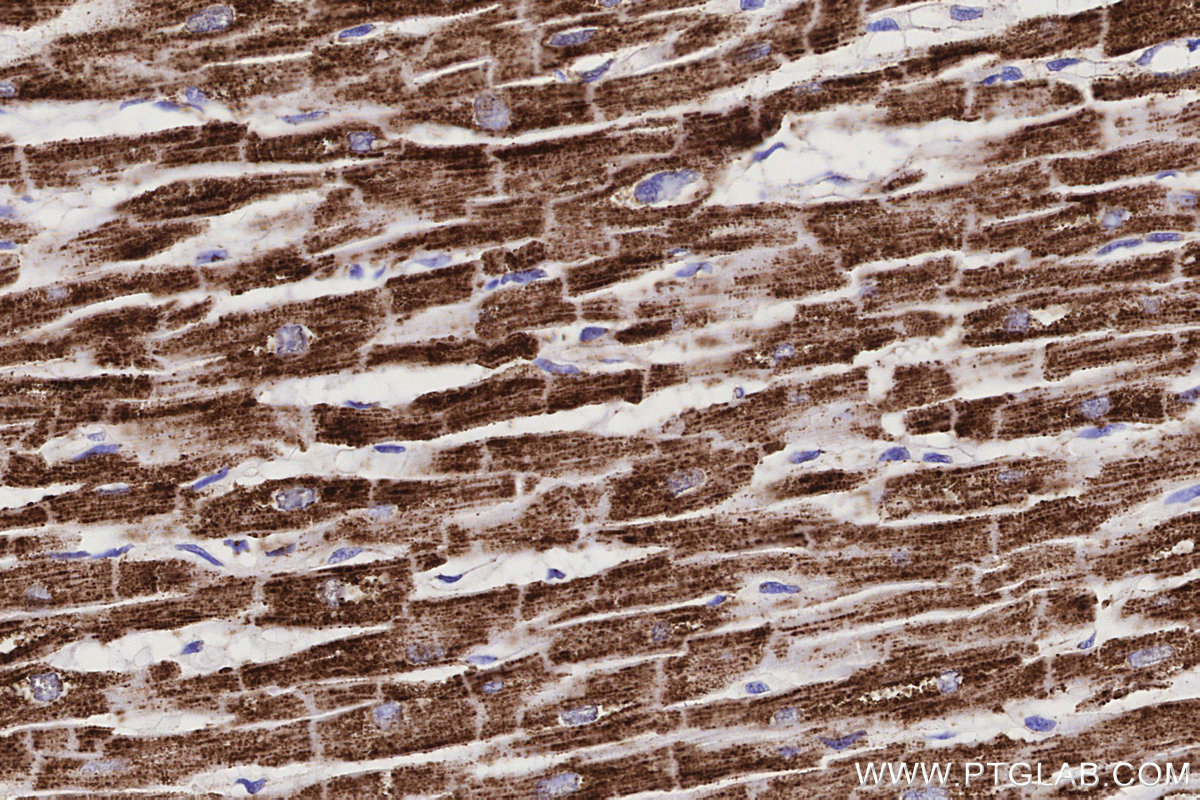 IHC staining of human heart using 68253-1-Ig IHC staining of human heart using 68253-1-Ig