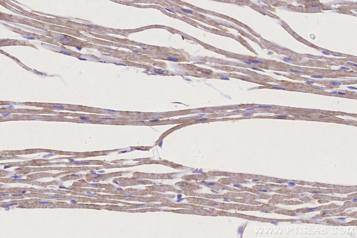 IHC staining of mouse heart using 68253-1-Ig IHC staining of mouse heart using 68253-1-Ig