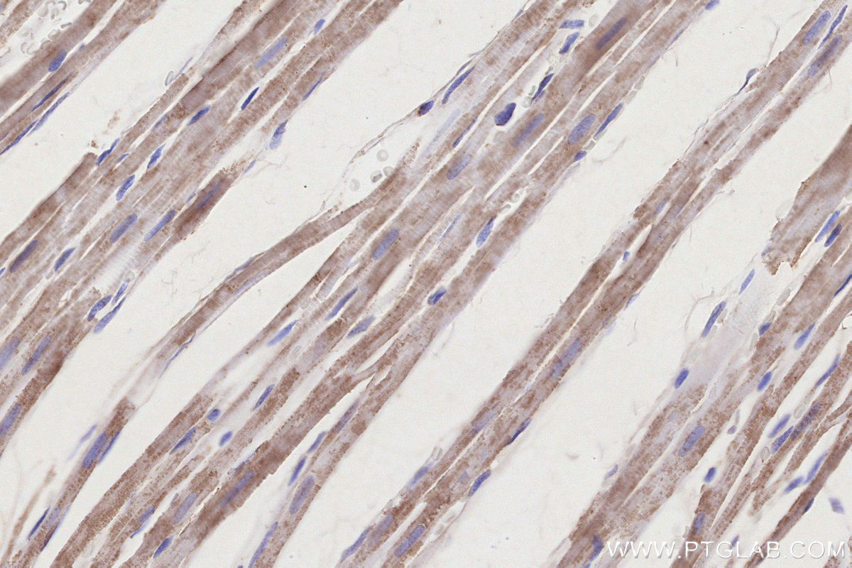 IHC staining of rat heart using 68253-1-Ig IHC staining of rat heart using 68253-1-Ig