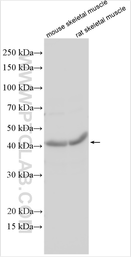 NDUFS2
