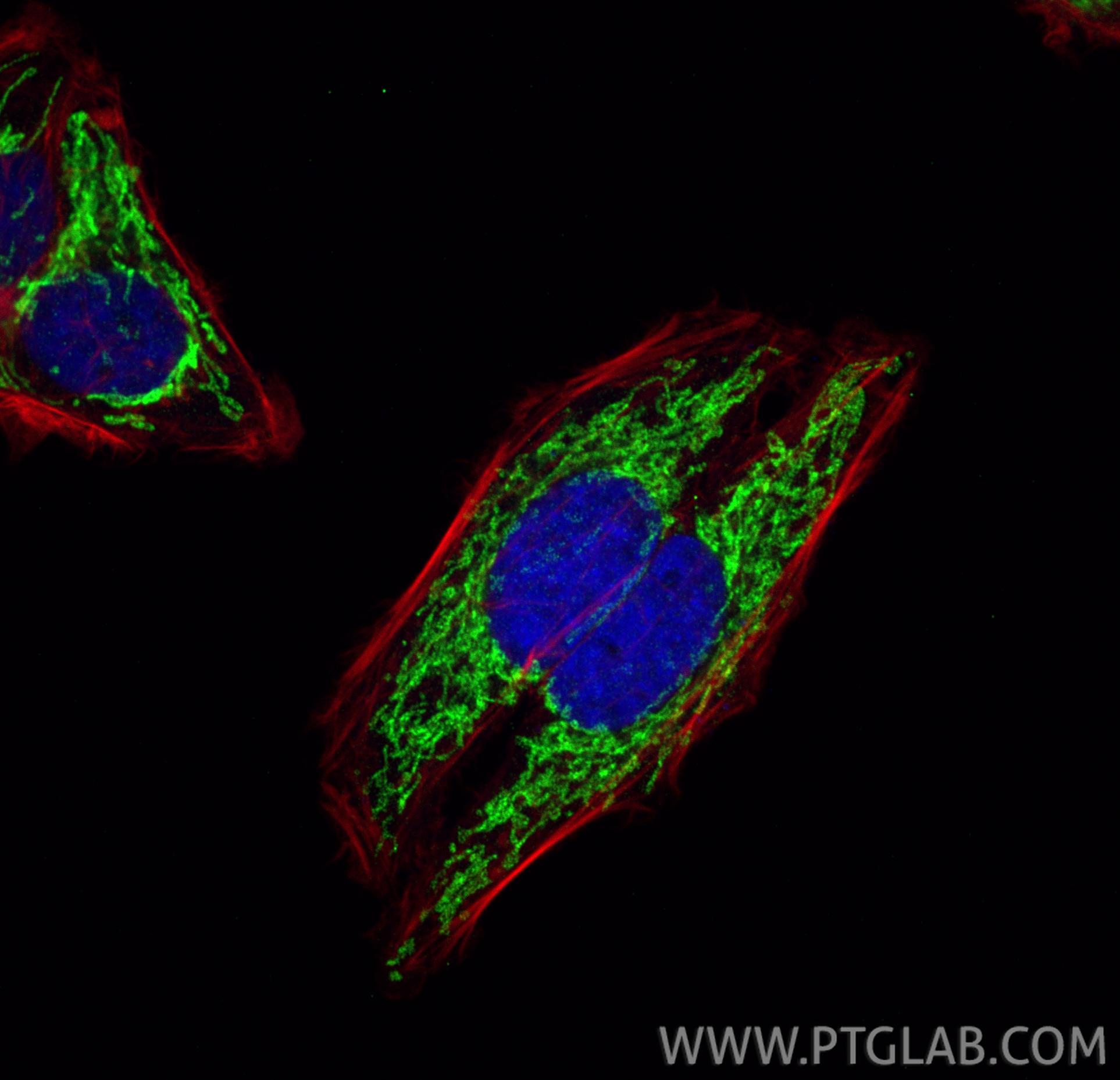 IF Staining of HepG2 using 15066-1-AP