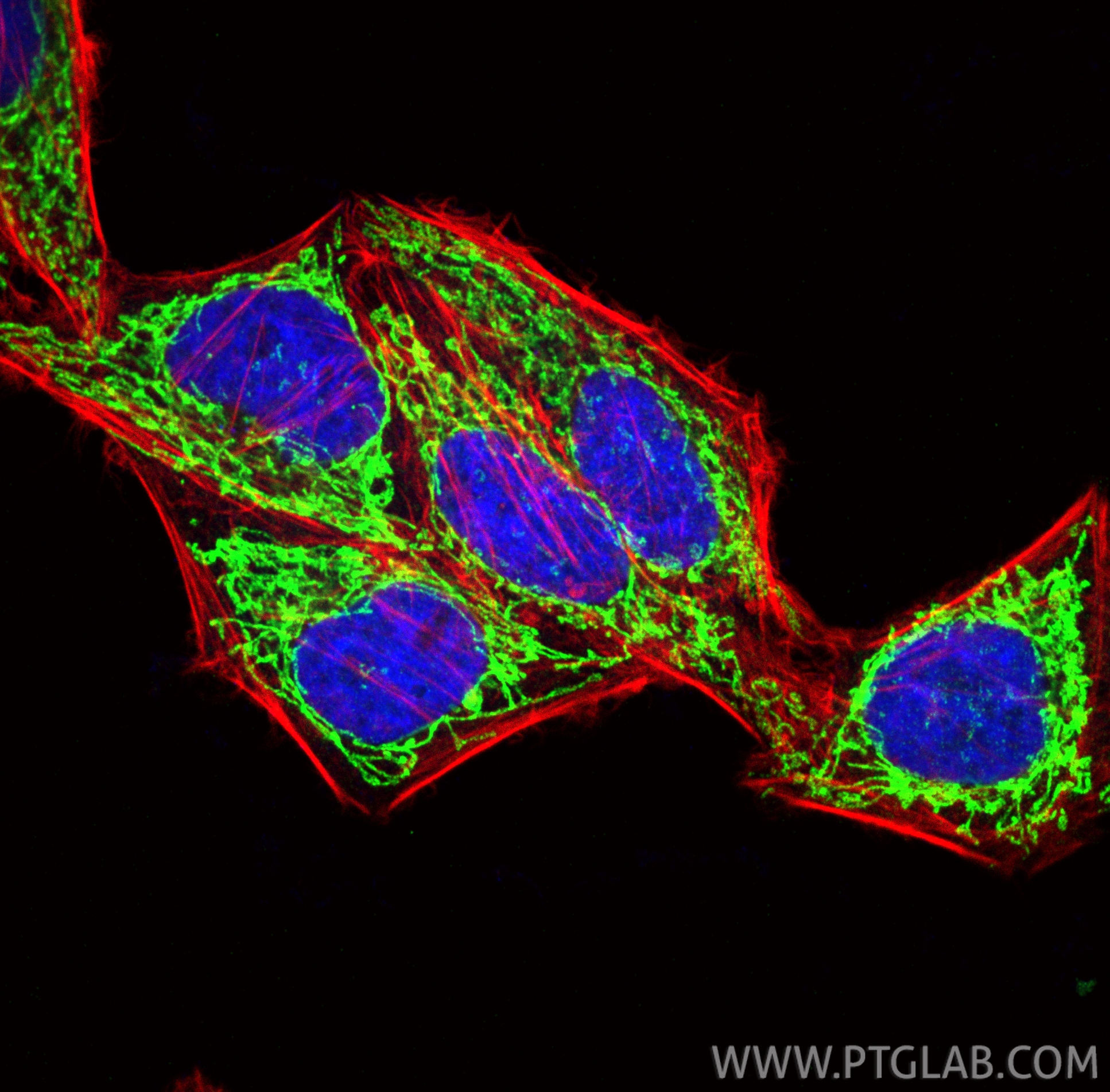 IF Staining of HepG2 using RMX00096 IF Staining of HepG2 using RMX00096