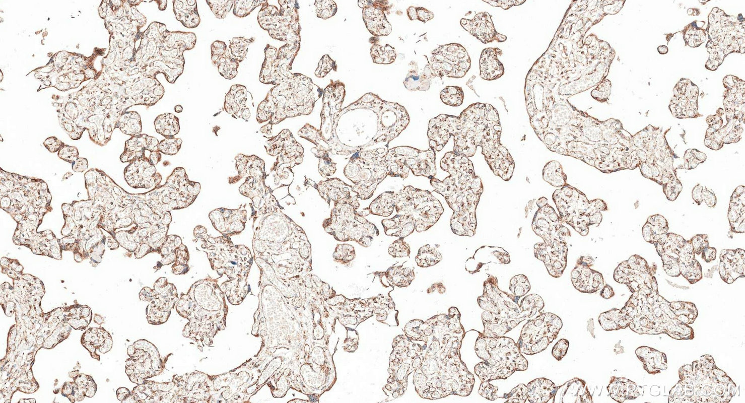 IHC staining of human placenta using RMX00096 IHC staining of human placenta using RMX00096