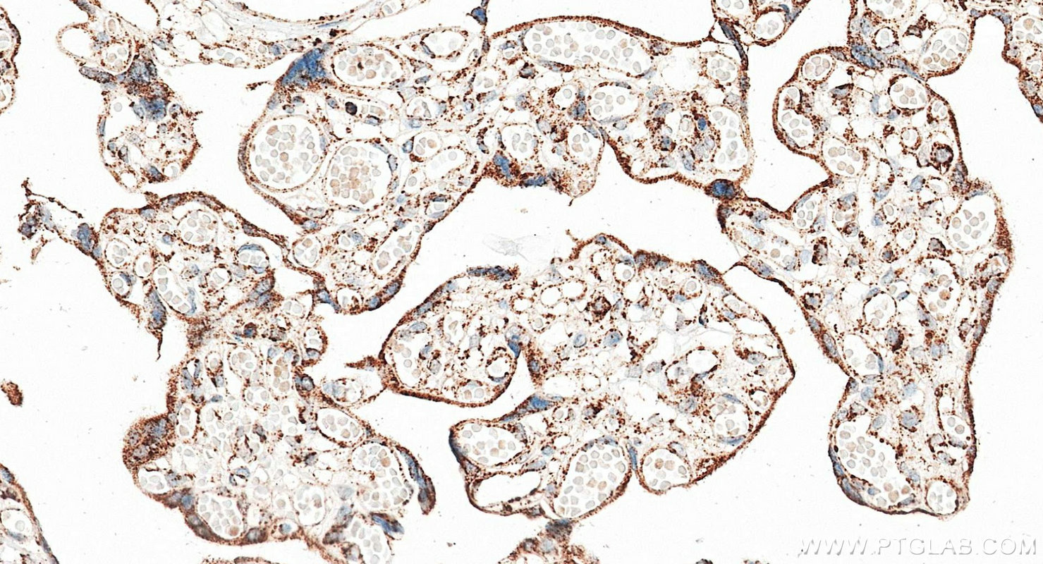 IHC staining of human placenta using RMX00096 IHC staining of human placenta using RMX00096