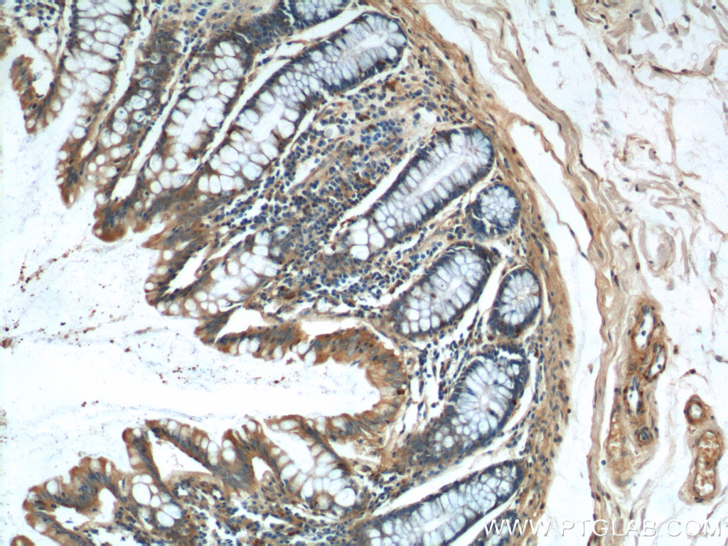 IHC staining of human colon using 15849-1-AP