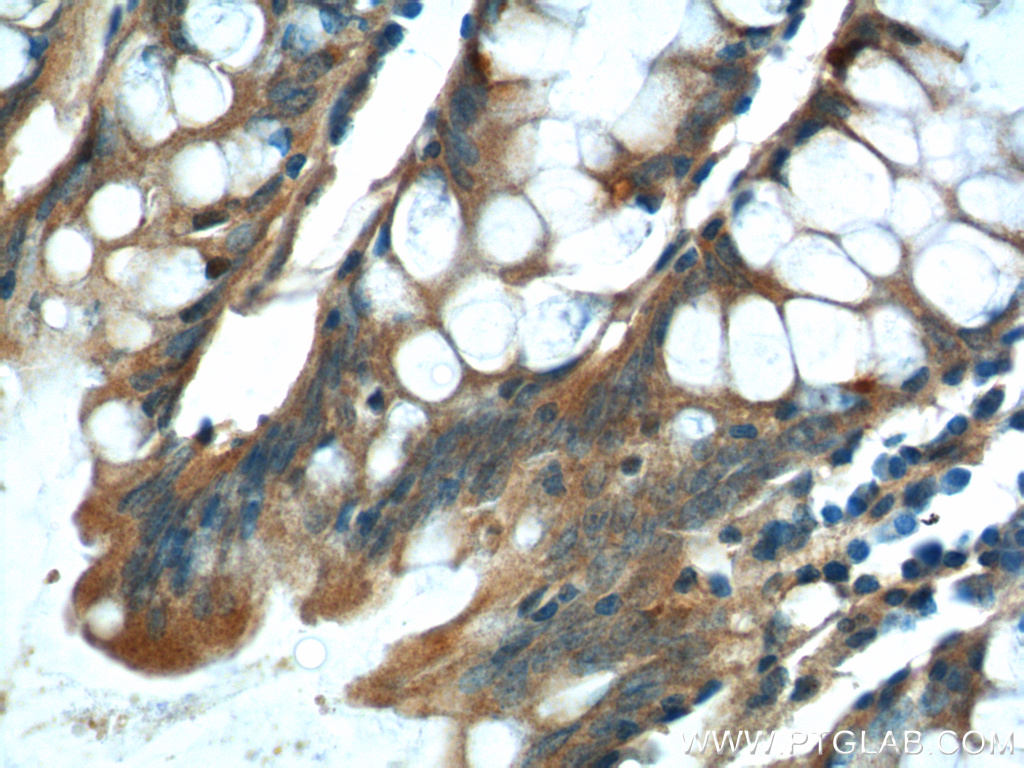 IHC staining of human colon using 15849-1-AP