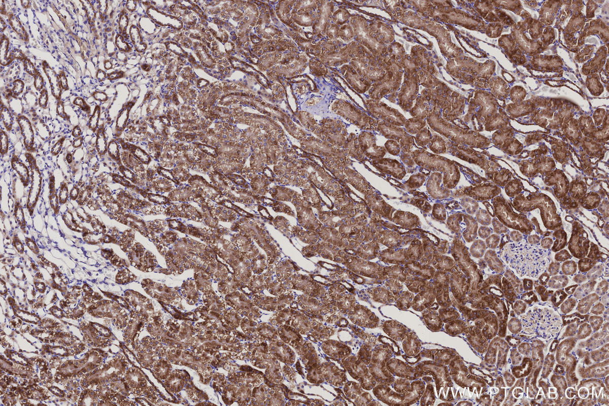 IHC staining of rat kidney using 66053-1-Ig