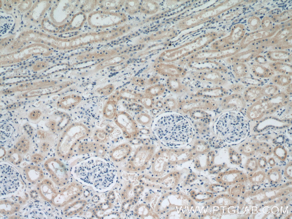 IHC staining of human kidney using 66053-1-Ig