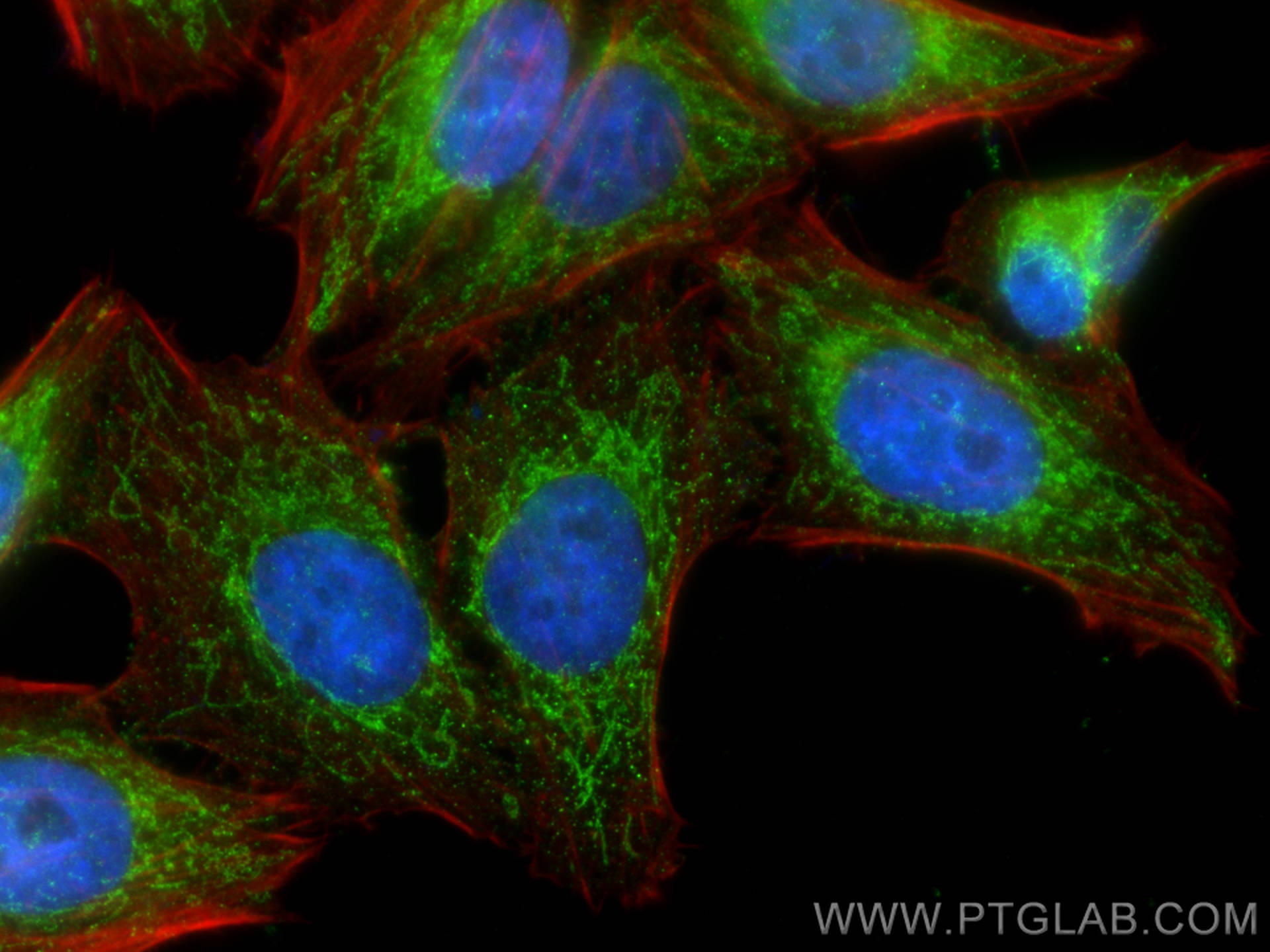 IF Staining of HepG2 using 14417-1-AP