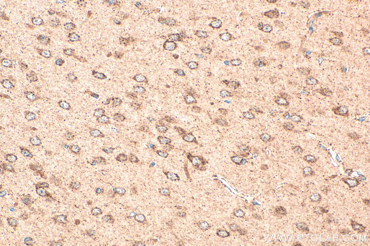 IHC staining of mouse brain using 14417-1-AP