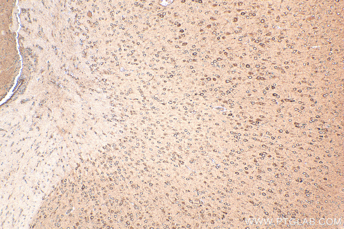 IHC staining of mouse brain using 14417-1-AP