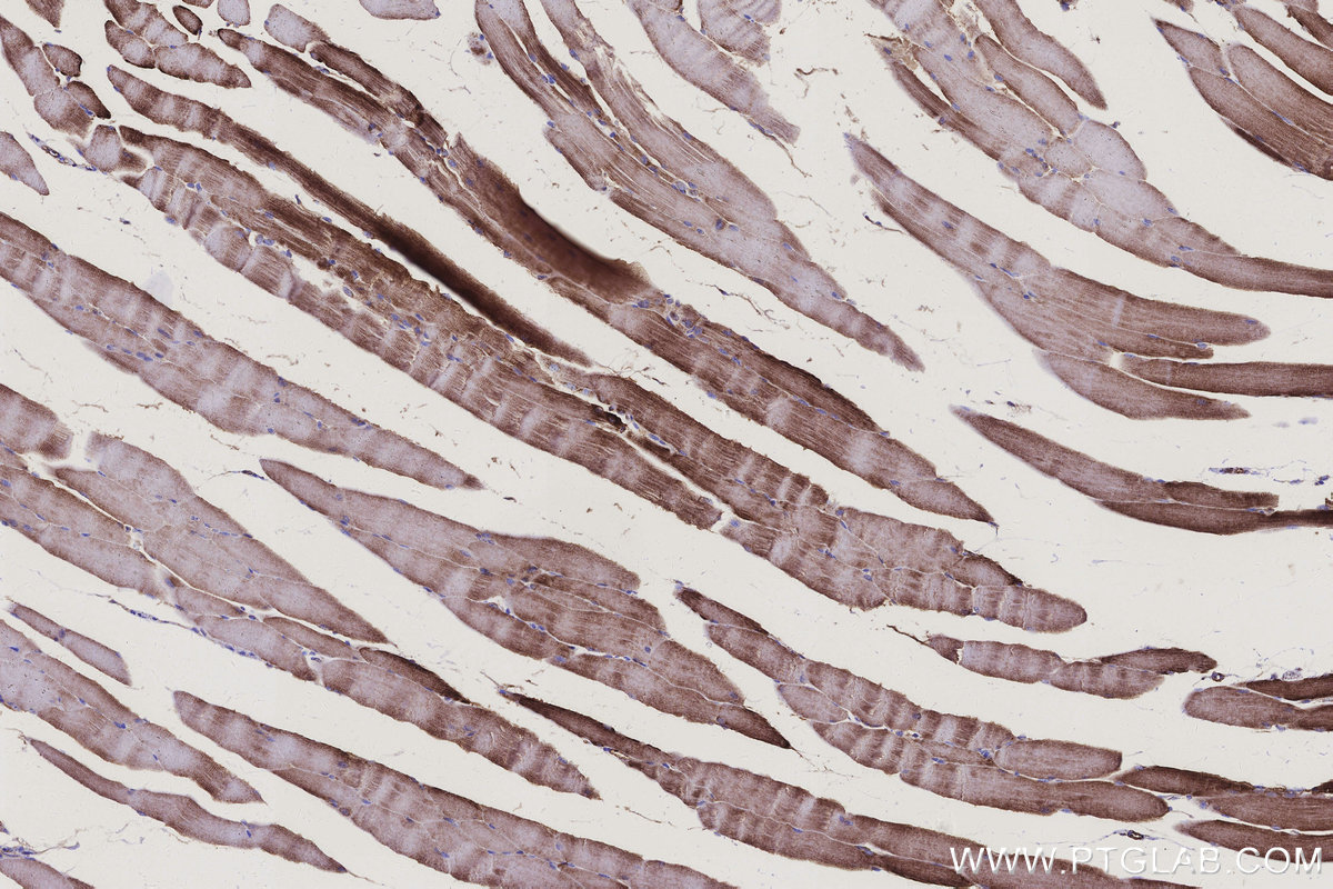 IHC staining of mouse skeletal muscle using 68329-1-Ig IHC staining of mouse skeletal muscle using 68329-1-Ig
