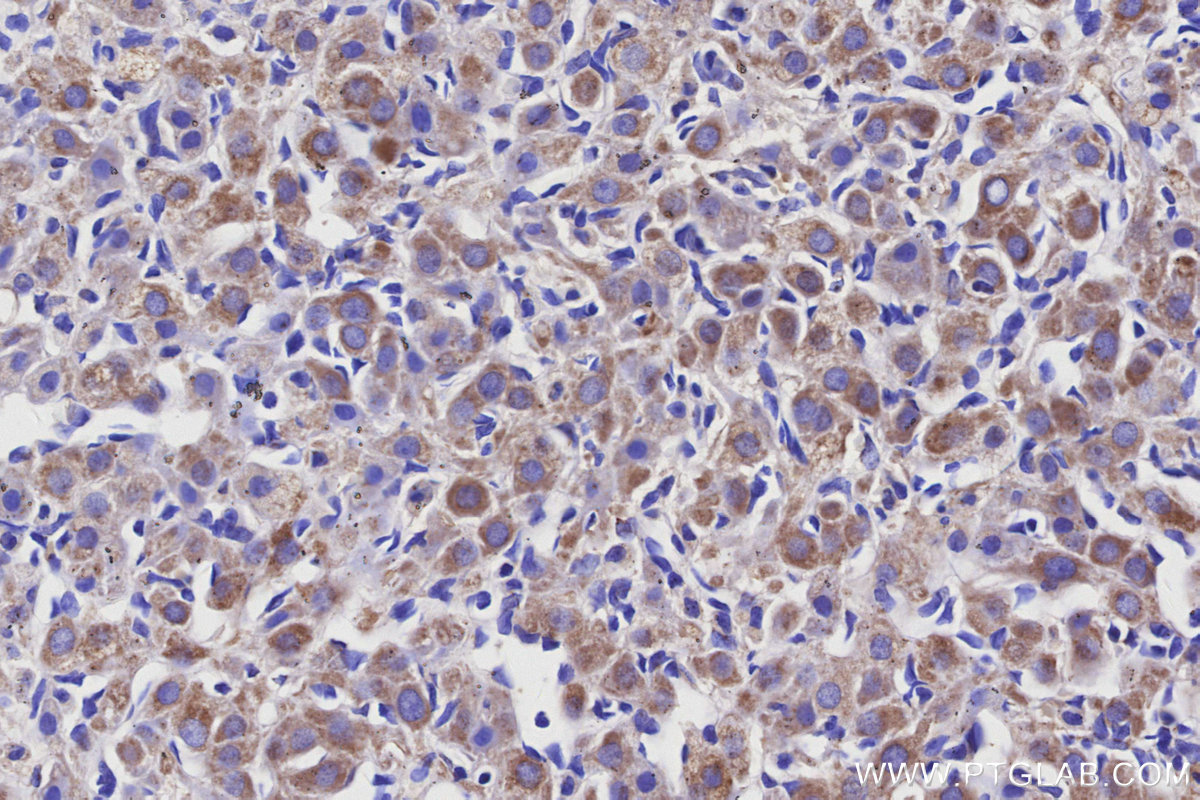 IHC staining of rat ovary using 68329-1-Ig IHC staining of rat ovary using 68329-1-Ig