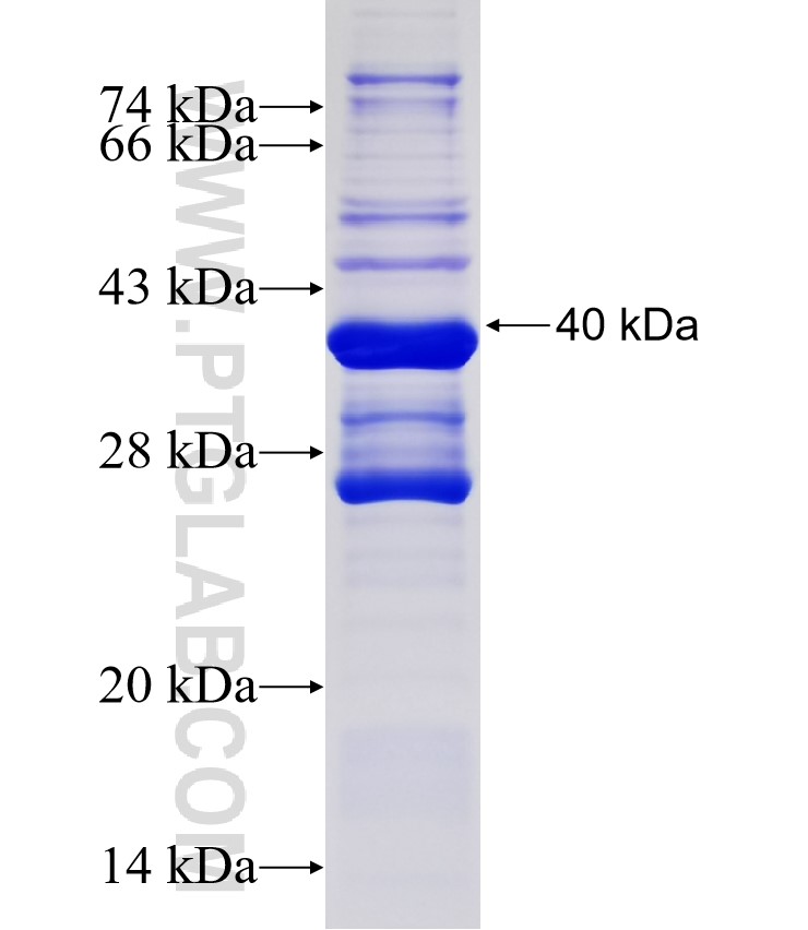 NDUFS6 fusion protein Ag5762 SDS-PAGE