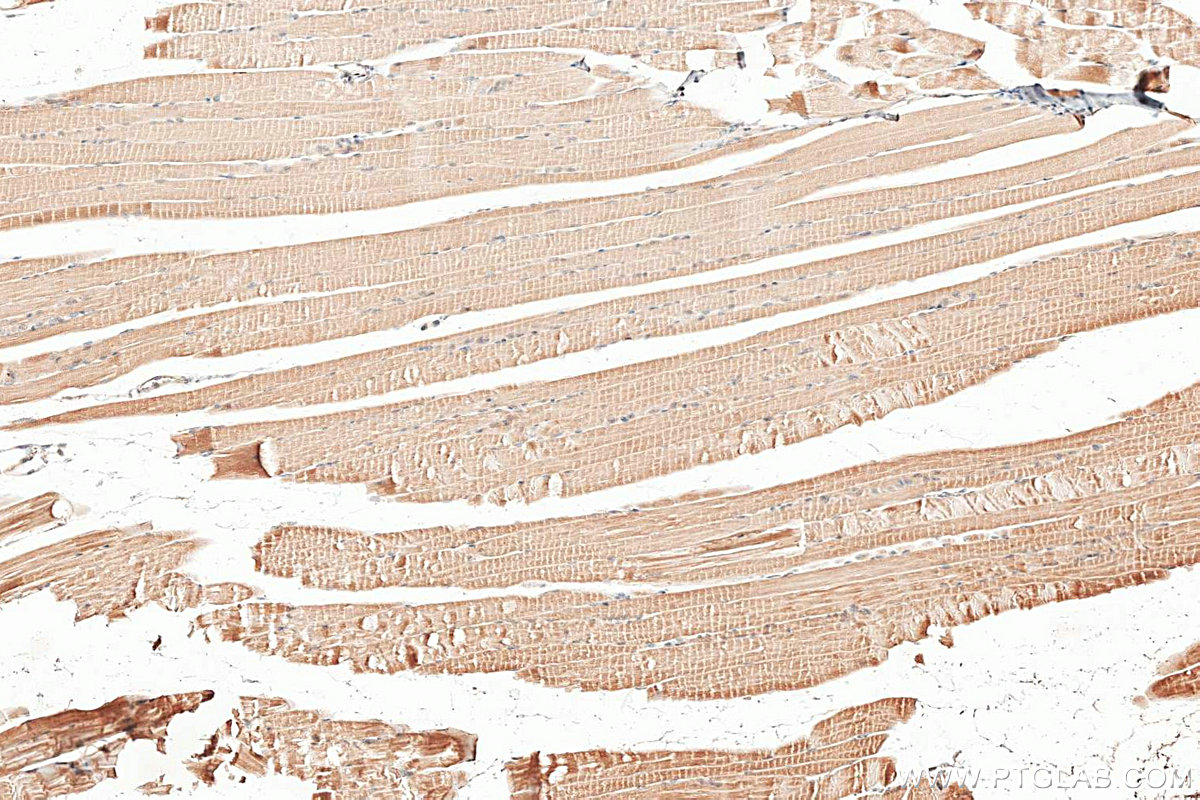 IHC staining of mouse skeletal muscle using 25172-1-AP IHC staining of mouse skeletal muscle using 25172-1-AP