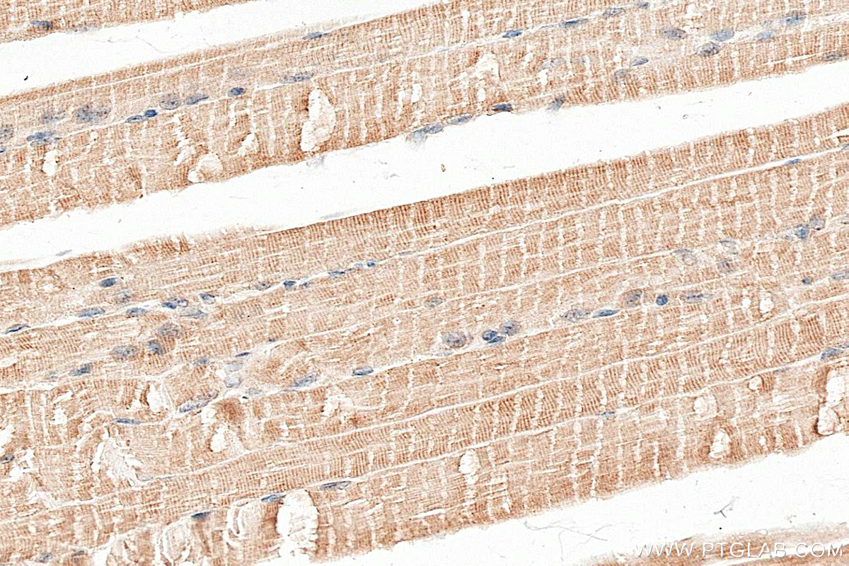 IHC staining of mouse skeletal muscle using 25172-1-AP IHC staining of mouse skeletal muscle using 25172-1-AP