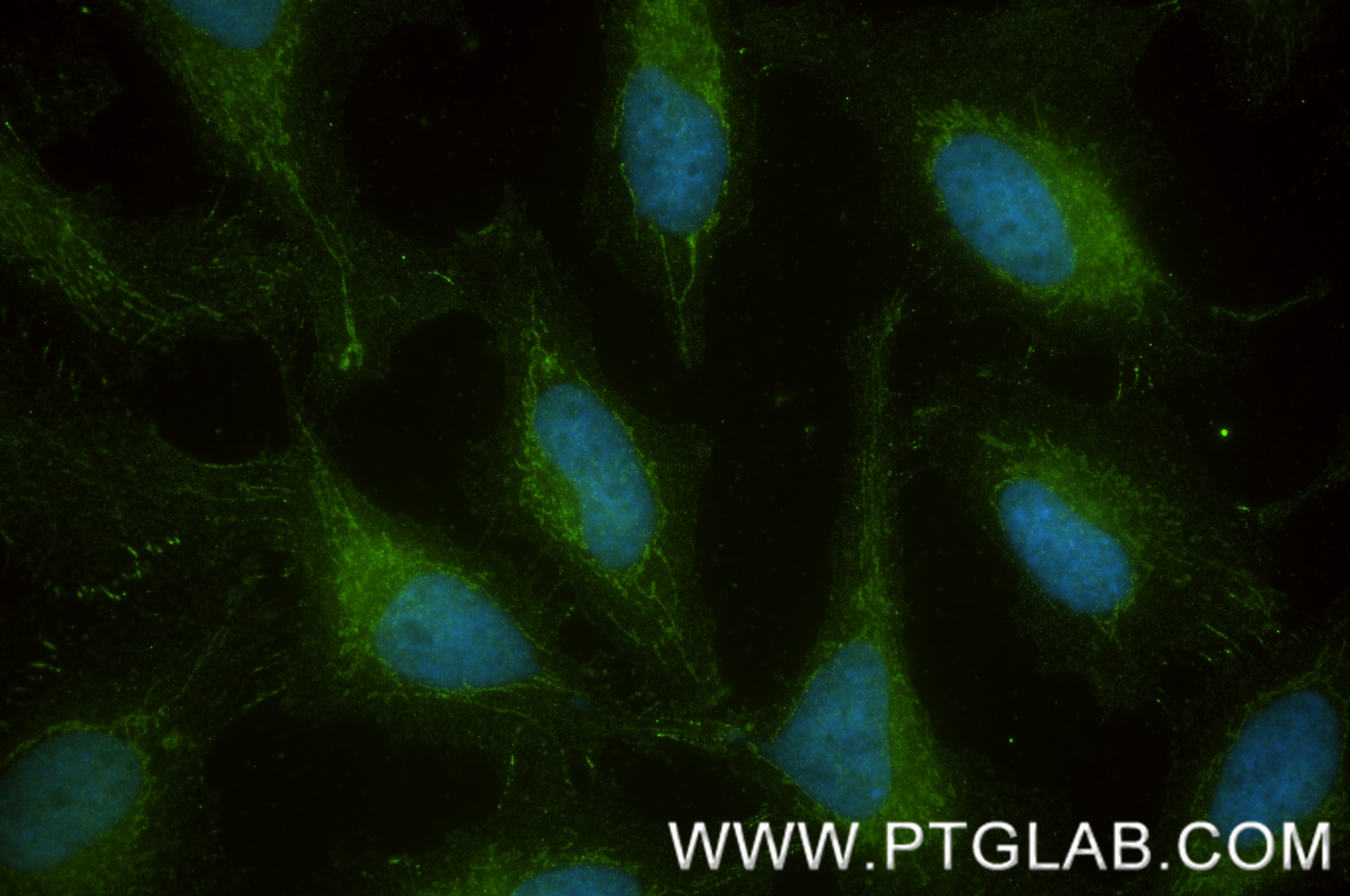 IF Staining of HeLa using 87156-1-RR IF Staining of HeLa using 87156-1-RR