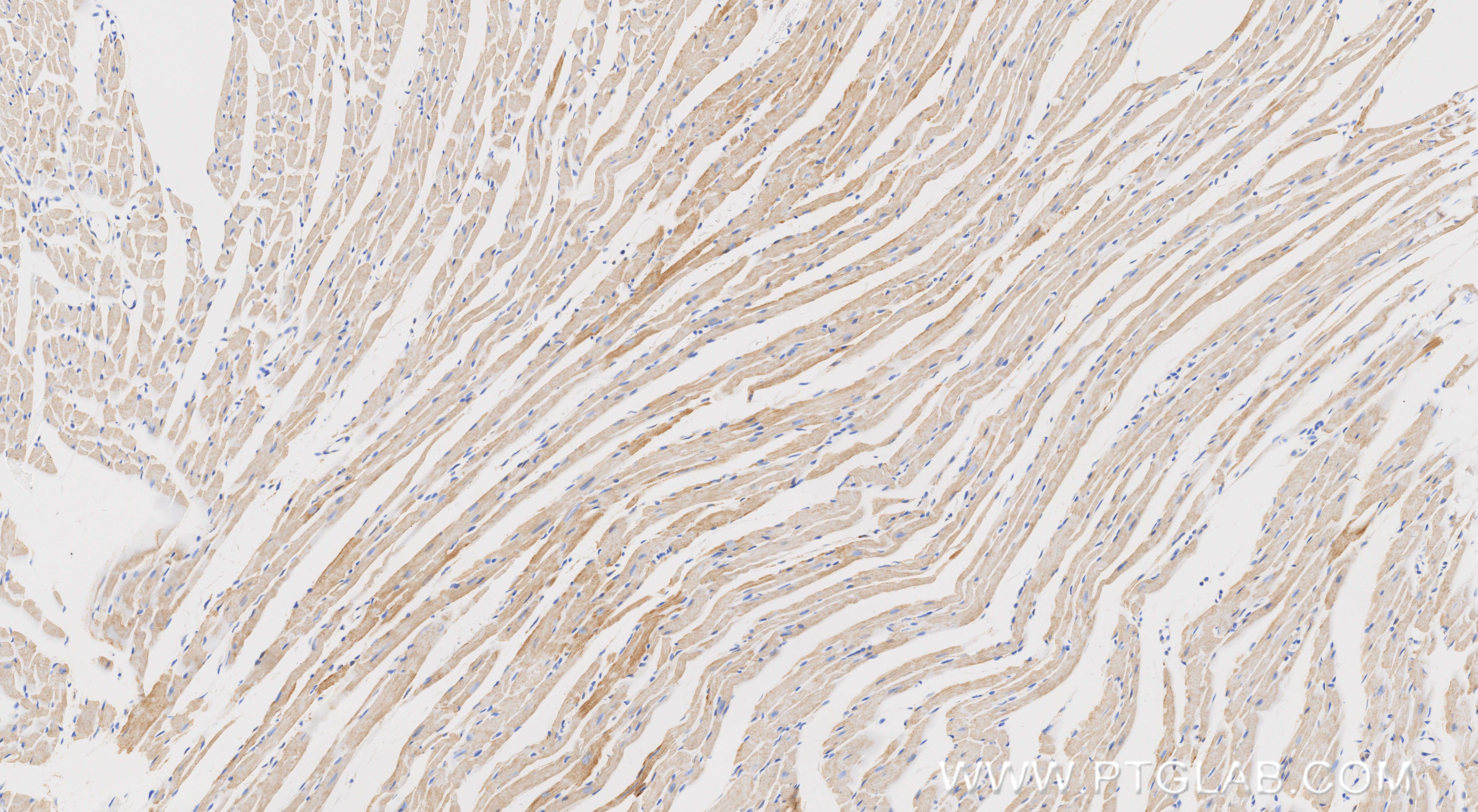 IHC staining of mouse heart using 87156-1-RR IHC staining of mouse heart using 87156-1-RR