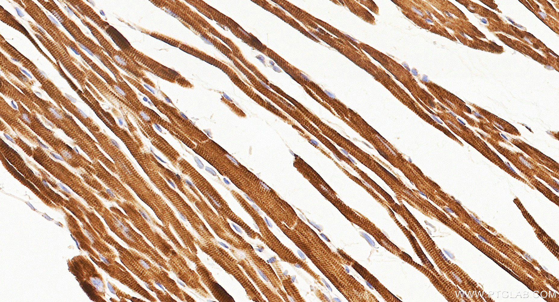 IHC staining of mouse heart using Biotin-87156 IHC staining of mouse heart using Biotin-87156