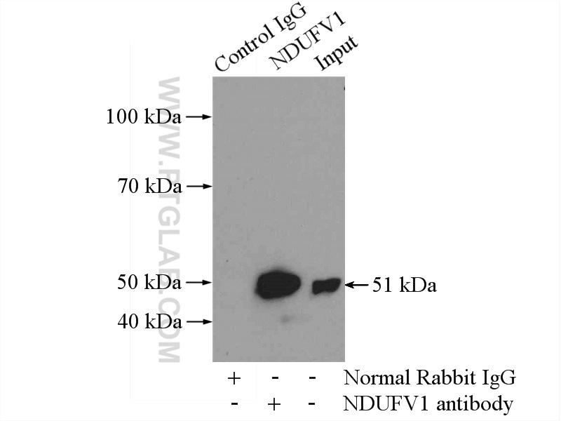 IP experiment of A431 using 11238-1-AP