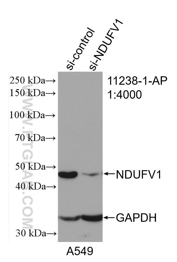 WB analysis of A549 using 11238-1-AP