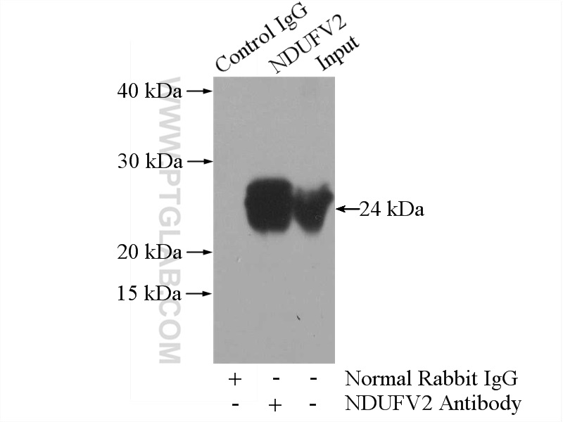 IP experiment of mouse heart using 15301-1-AP