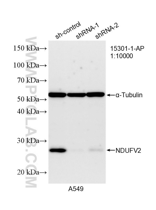 WB analysis of A549 using 15301-1-AP