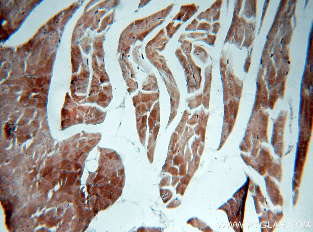 IHC staining of human skeletal muscle using 19706-1-AP (same clone as 19706-1-PBS)