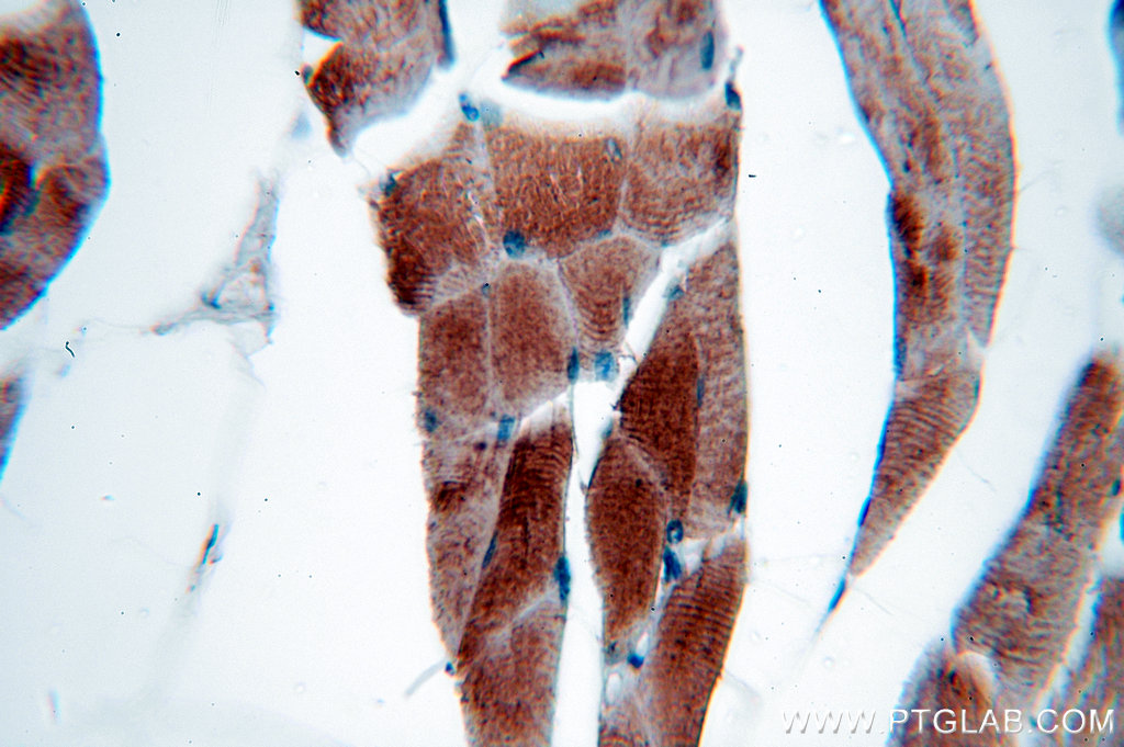 IHC staining of human skeletal muscle using 19706-1-AP (same clone as 19706-1-PBS)